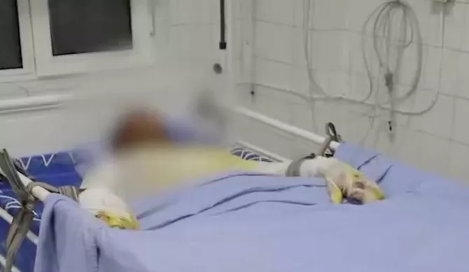 Dangerous Selfie Attempt Leaves Teen in Critical Condition in Uzbekistan