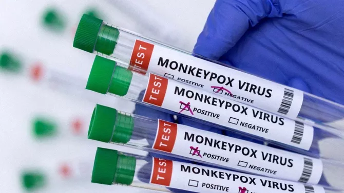 Is Monkeypox Becoming a Concern in Russia Again?