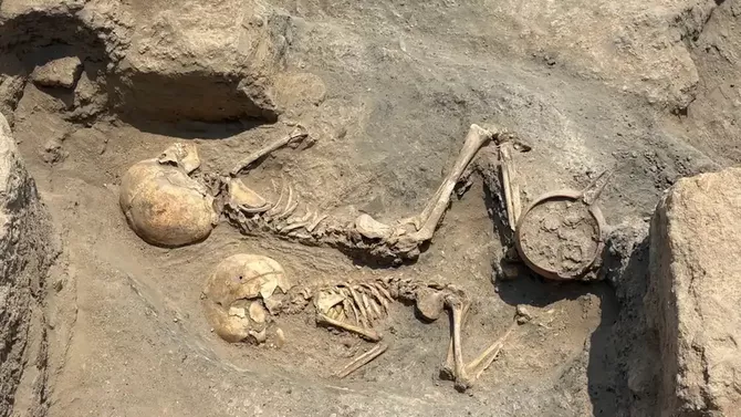 Bronze Age 5-Year-Old’s Skull Found in Uzbekistan Is The Oldest Known Evidence of Surgery In Central Asia