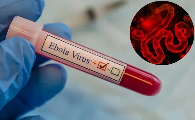 Uzbekistan Introduces New Ebola-Related Rules for US-Bound Passengers