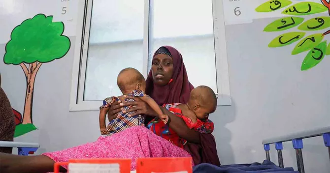 Somalia's Malnourished Children Hit Hard by Iran War