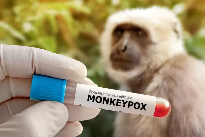 Russia Confirms Five Monkeypox Cases in St. Petersburg - Caspianpost.com