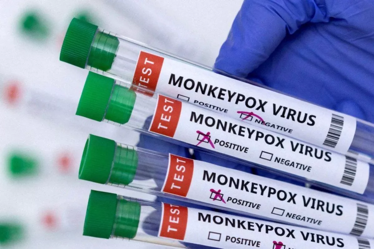 Is Monkeypox Becoming a Concern in Russia Again?