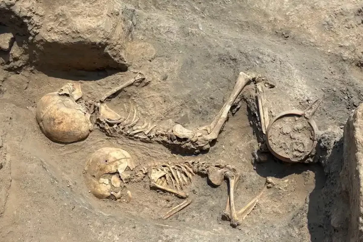 Bronze Age 5-Year-Old’s Skull Found in Uzbekistan Is The Oldest Known Evidence of Surgery In Central Asia