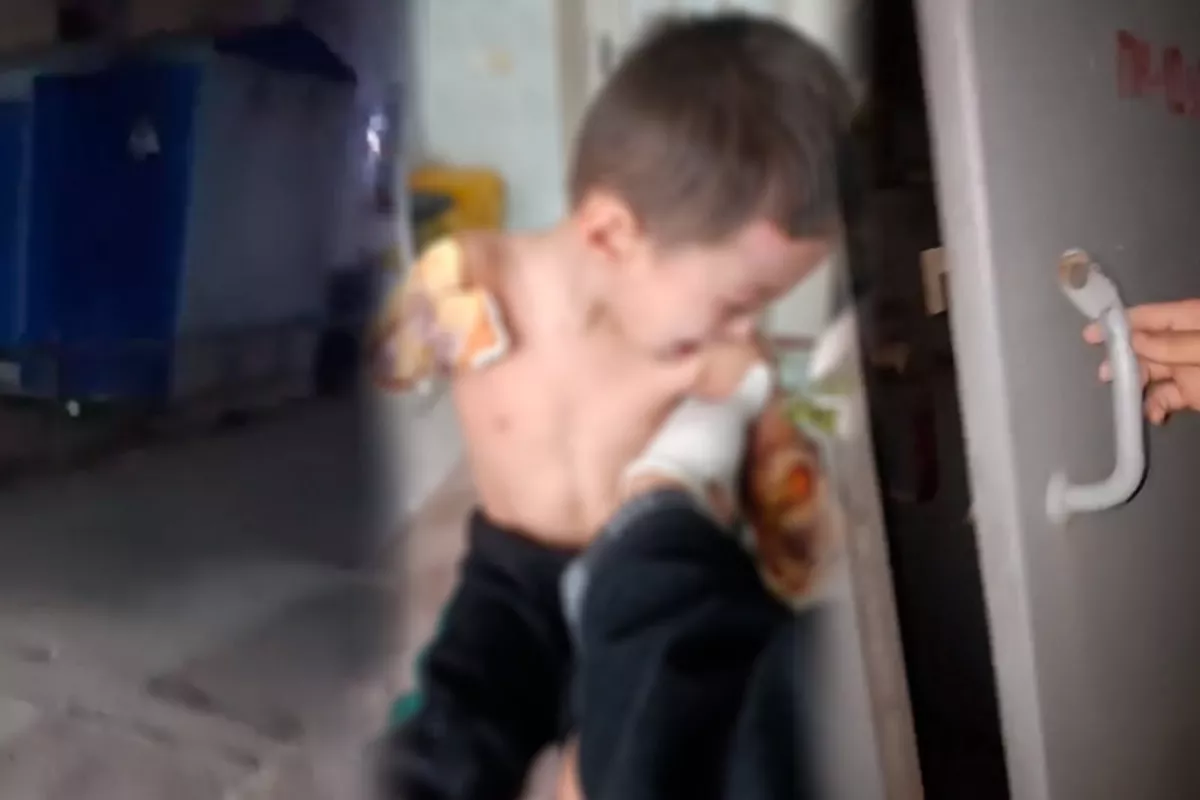 Child in Uzbekistan Loses Both Arms After Electric Shock in Transformer Box
