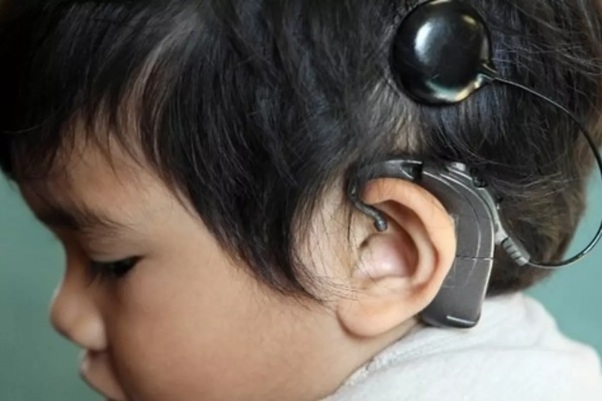 Qatari Surgeons Bring New Hope to Kyrgyz Children with Hearing Loss