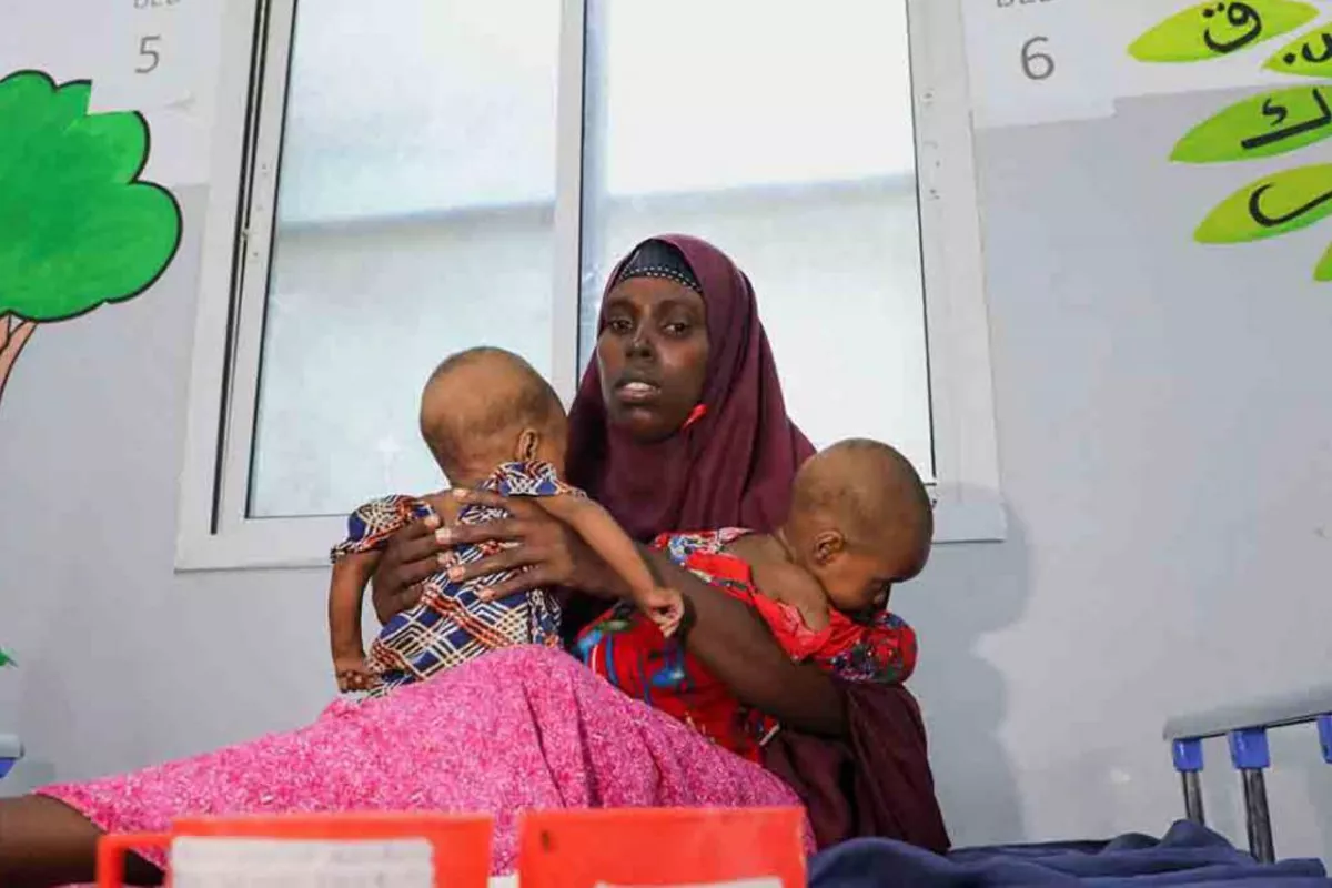 Somalia's Malnourished Children Hit Hard by Iran War