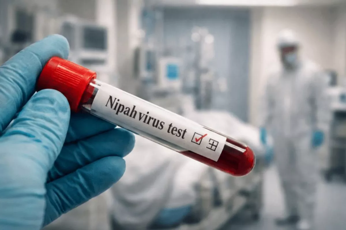 Nipah Virus: What Central Asia Needs to Be Ready For