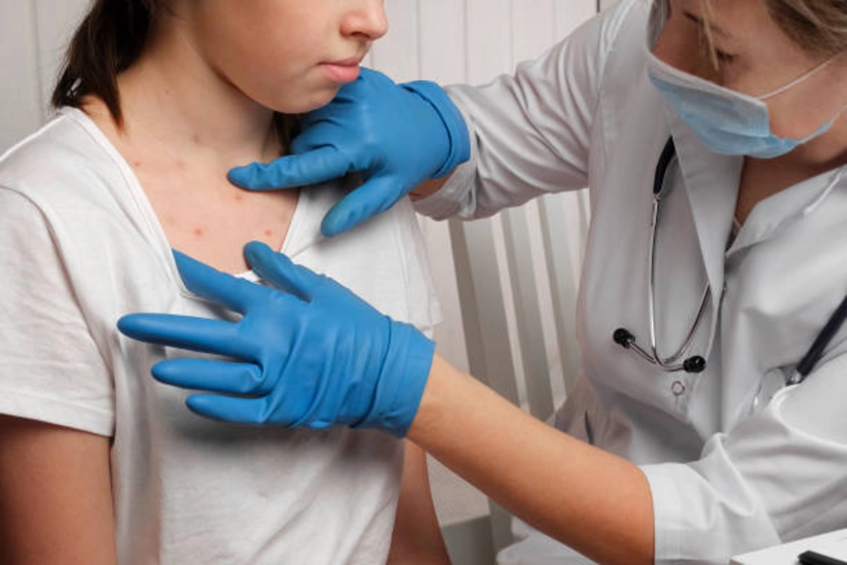 EU Pledges €200,000 to Combat Measles Outbreak in Kyrgyzstan