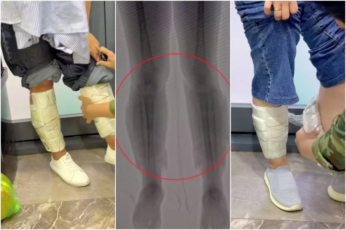 Uzbek Customs Seize $240,000 Hidden on Women’s Legs