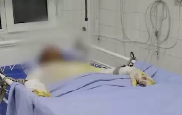 Dangerous Selfie Attempt Leaves Teen in Critical Condition in Uzbekistan