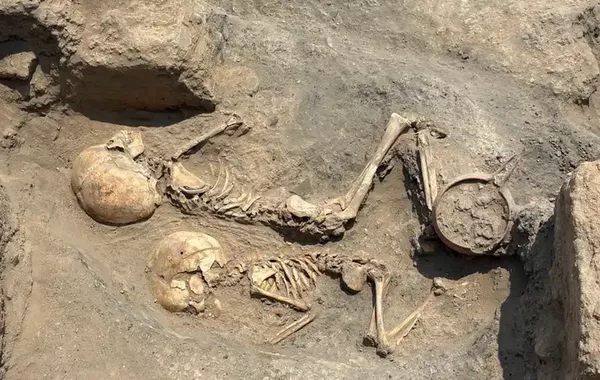 Bronze Age 5-Year-Old’s Skull Found in Uzbekistan Is The Oldest Known Evidence of Surgery In Central Asia