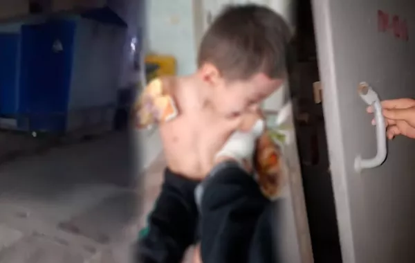 Child in Uzbekistan Loses Both Arms After Electric Shock in Transformer Box