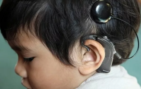 Qatari Surgeons Bring New Hope to Kyrgyz Children with Hearing Loss