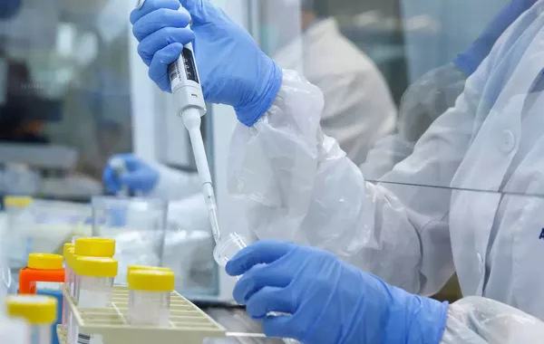 No Epidemic Risk Reported After Pneumonia Case in Russia's Irkutsk