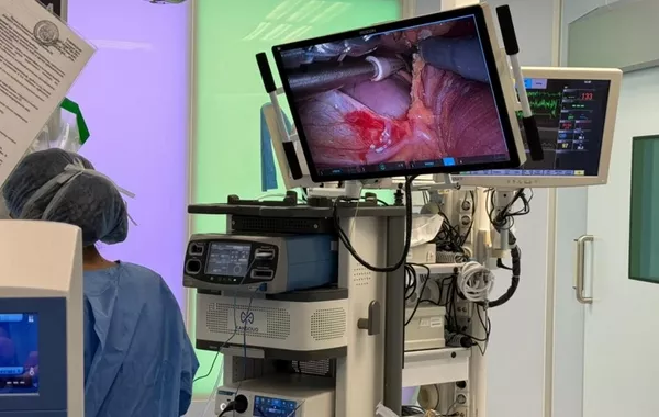 Kazakhstan Performs Central Asia’s First Robot-Assisted Heart Surgery