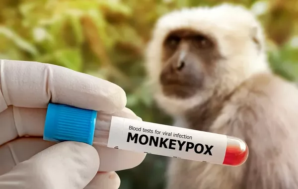 Russia Confirms Five Monkeypox Cases in St. Petersburg