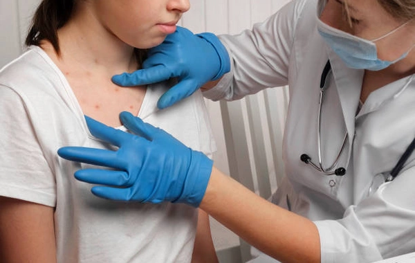 EU Pledges €200,000 to Combat Measles Outbreak in Kyrgyzstan