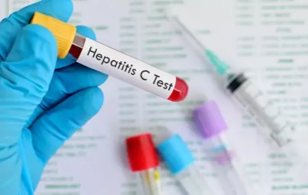 WHO May Give Georgia Hepatitis C-Free Status Soon