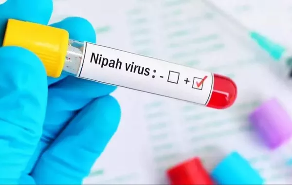 Uzbekistan Restricts Imports from India Over Nipah