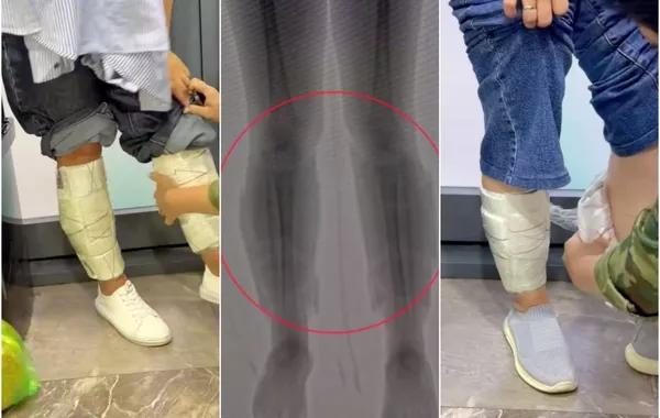 Uzbek Customs Seize $240,000 Hidden on Women’s Legs